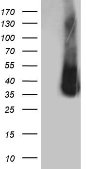 ZCCHC17 Antibody (OTI1F11) Western Blot;ZCCHC17 Antibody (OTI1F11)[NBP3-44765]-