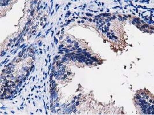 PEPD Antibody (OTI5D5) Immunohistochemistry;PEPD Antibody (OTI5D5)[NBP3-44638]-
