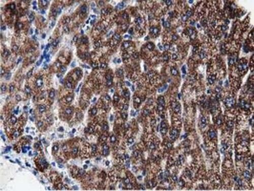 PEPD Antibody (OTI5D5) Immunohistochemistry;PEPD Antibody (OTI5D5)[NBP3-44638]-