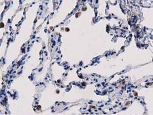 PEPD Antibody (OTI5D5) Immunohistochemistry;PEPD Antibody (OTI5D5)[NBP3-44638]-