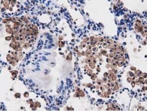 PEPD Antibody (OTI5D5) Immunohistochemistry;PEPD Antibody (OTI5D5)[NBP3-44638]-