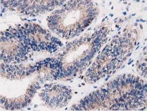 PEPD Antibody (OTI5D5) Immunohistochemistry;PEPD Antibody (OTI5D5)[NBP3-44638]-