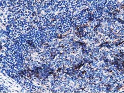 PEPD Antibody (OTI5D5) Immunohistochemistry;PEPD Antibody (OTI5D5)[NBP3-44638]-