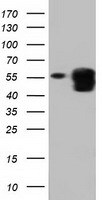 PEPD Antibody (OTI5D5) Western Blot;PEPD Antibody (OTI5D5)[NBP3-44638]-