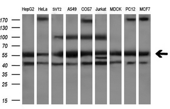 PEPD Antibody (OTI5D5) Western Blot;PEPD Antibody (OTI5D5)[NBP3-44638]-