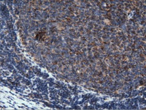 PEPD Antibody (OTI1B7) Immunohistochemistry;PEPD Antibody (OTI1B7)[NBP3-44639]-