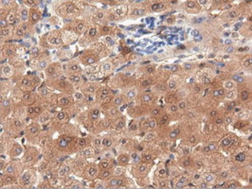 PEPD Antibody (OTI1B7) Immunohistochemistry;PEPD Antibody (OTI1B7)[NBP3-44639]-