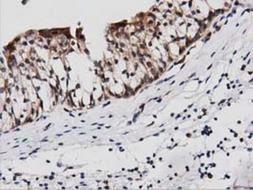 PEPD Antibody (OTI1B7) Immunohistochemistry;PEPD Antibody (OTI1B7)[NBP3-44639]-