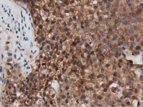 PEPD Antibody (OTI1B7) Immunohistochemistry;PEPD Antibody (OTI1B7)[NBP3-44639]-