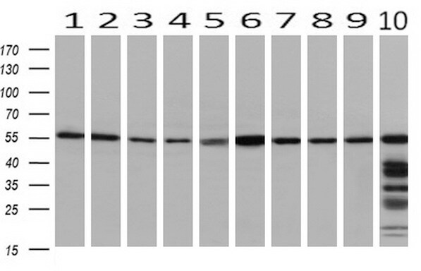 PEPD Antibody (OTI1B7) Western Blot;PEPD Antibody (OTI1B7)[NBP3-44639]-