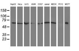 XPNPEP3 Antibody (OTI5G2) Western Blot;XPNPEP3 Antibody (OTI5G2)[NBP3-44640]-