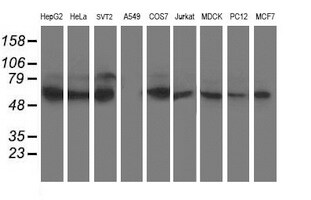 XPNPEP3 Antibody (OTI4B8) Western Blot;XPNPEP3 Antibody (OTI4B8)[NBP3-44641]-