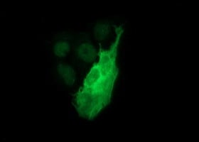 Tyrosine Hydroxylase Antibody (OTI1A10) Immunocytochemistry/ Immunofluorescence;Tyrosine Hydroxylase Antibody (OTI1A10)[NBP3-44649]-