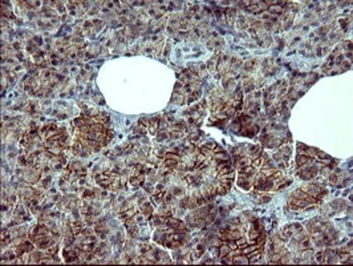 Tyrosine Hydroxylase Antibody (OTI1A10) Immunohistochemistry;Tyrosine Hydroxylase Antibody (OTI1A10)[NBP3-44649]-