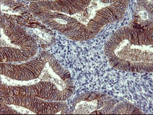 Tyrosine Hydroxylase Antibody (OTI1A10) Immunohistochemistry;Tyrosine Hydroxylase Antibody (OTI1A10)[NBP3-44649]-