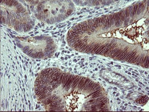 Tyrosine Hydroxylase Antibody (OTI1A10) Immunohistochemistry;Tyrosine Hydroxylase Antibody (OTI1A10)[NBP3-44649]-