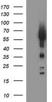 Tyrosine Hydroxylase Antibody (OTI1A10) Western Blot;Tyrosine Hydroxylase Antibody (OTI1A10)[NBP3-44649]-