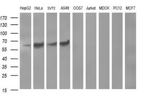 Tyrosine Hydroxylase Antibody (OTI1A10) Western Blot;Tyrosine Hydroxylase Antibody (OTI1A10)[NBP3-44649]-