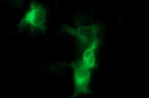 Tyrosine Hydroxylase Antibody (OTI2E6) Immunocytochemistry/ Immunofluorescence;Tyrosine Hydroxylase Antibody (OTI2E6)[NBP3-44652]-