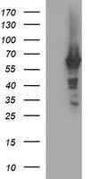 Tyrosine Hydroxylase Antibody (OTI2E6) Western Blot;Tyrosine Hydroxylase Antibody (OTI2E6)[NBP3-44652]-