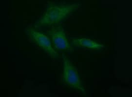 Tyrosine Hydroxylase Antibody (OTI3G3) Immunocytochemistry/ Immunofluorescence;Tyrosine Hydroxylase Antibody (OTI3G3)[NBP3-44654]-
