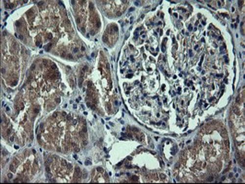 Tyrosine Hydroxylase Antibody (OTI3G3) Immunohistochemistry;Tyrosine Hydroxylase Antibody (OTI3G3)[NBP3-44654]-