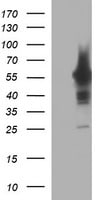 Tyrosine Hydroxylase Antibody (OTI3G3) Western Blot;Tyrosine Hydroxylase Antibody (OTI3G3)[NBP3-44654]-