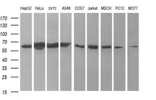 Tyrosine Hydroxylase Antibody (OTI2D4) Western Blot;Tyrosine Hydroxylase Antibody (OTI2D4)[NBP3-44655]-