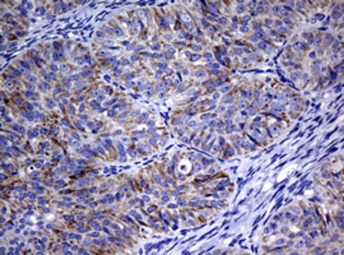 DNA Polymerase iota Antibody (OTI3B5) Immunohistochemistry;DNA Polymerase iota Antibody (OTI3B5)[NBP3-44668]-