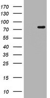 DNA Polymerase iota Antibody (OTI3B5) Western Blot;DNA Polymerase iota Antibody (OTI3B5)[NBP3-44668]-