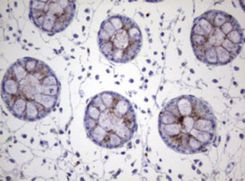 NEU-1/Sialidase-1 Antibody (OTI3B3) Immunohistochemistry;NEU-1/Sialidase-1 Antibody (OTI3B3)[NBP3-44669]-