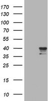 NEU-1/Sialidase-1 Antibody (OTI3F5) Western Blot;NEU-1/Sialidase-1 Antibody (OTI3F5)[NBP3-44673]-