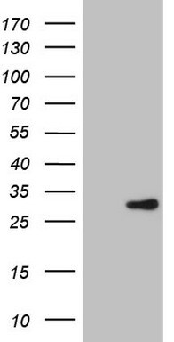 XPD Antibody (OTI4B11) Western Blot;XPD Antibody (OTI4B11)[NBP3-44677]-