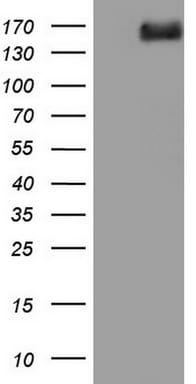 DCC Antibody (OTI4A1) Western Blot;DCC Antibody (OTI4A1)[NBP3-44682]-