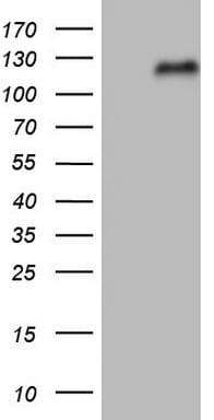 Nrf2 Antibody (OTI8A10) Western Blot;Nrf2 Antibody (OTI8A10)[NBP3-44685]-