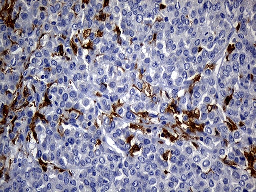 UBE3B Antibody (OTI3F10) Immunohistochemistry;UBE3B Antibody (OTI3F10)[NBP3-44687]-