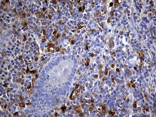UBE3B Antibody (OTI3F10) Immunohistochemistry;UBE3B Antibody (OTI3F10)[NBP3-44687]-