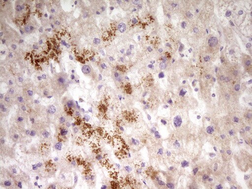 PAPSS2 Antibody (OTI3H10) Immunohistochemistry;PAPSS2 Antibody (OTI3H10)[NBP3-44688]-