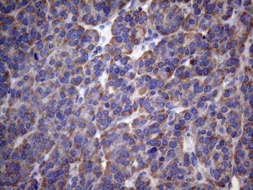 PAPSS2 Antibody (OTI6H10) Immunohistochemistry;PAPSS2 Antibody (OTI6H10)[NBP3-44692]-