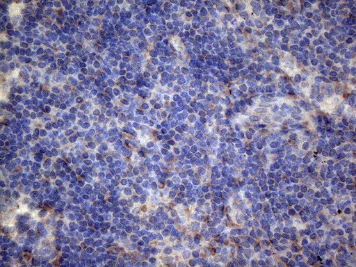 PAPSS2 Antibody (OTI6H10) Immunohistochemistry;PAPSS2 Antibody (OTI6H10)[NBP3-44692]-