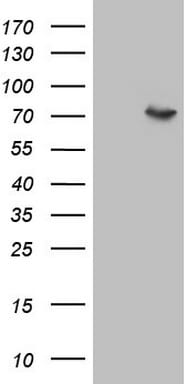 Factor XII Antibody (OTI5A6) Western Blot;Factor XII Antibody (OTI5A6)[NBP3-44695]-