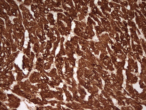 Cardiac Troponin T Antibody (OTI7D2) Immunohistochemistry;Cardiac Troponin T Antibody (OTI7D2)[NBP3-44698]-