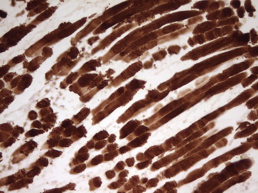 Cardiac Troponin T Antibody (OTI3C3) Immunohistochemistry;Cardiac Troponin T Antibody (OTI3C3)[NBP3-44700]-
