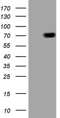 Alas1 Antibody (OTI5D5) Western Blot;Alas1 Antibody (OTI5D5)[NBP3-44704]-