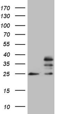 MRPS15 Antibody (OTI6D2) Western Blot;MRPS15 Antibody (OTI6D2)[NBP3-44705]-