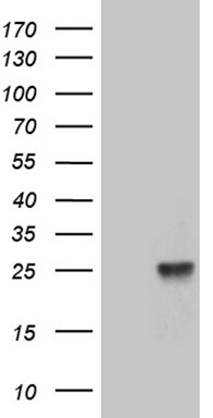 TEX30 Antibody (OTI7C3) Western Blot;TEX30 Antibody (OTI7C3)[NBP3-44706]-