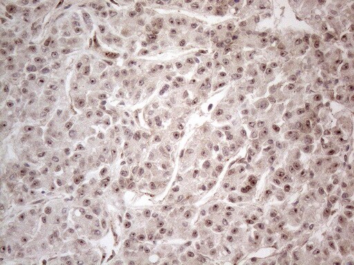 HMGB4 Antibody (OTI5G3) Immunohistochemistry;HMGB4 Antibody (OTI5G3)[NBP3-44707]-