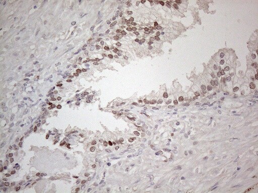 HMGB4 Antibody (OTI5G3) Immunohistochemistry;HMGB4 Antibody (OTI5G3)[NBP3-44707]-
