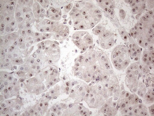 HMGB4 Antibody (OTI5G3) Immunohistochemistry;HMGB4 Antibody (OTI5G3)[NBP3-44707]-