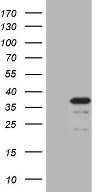 MRPS15 Antibody (OTI5F5) Western Blot;MRPS15 Antibody (OTI5F5)[NBP3-44708]-